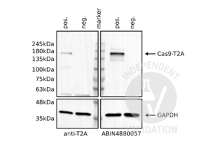Western Blotting validation image for anti-CRISPR-Cas9 (N-Term) antibody (ABIN4880057) (CRISPR-Cas9 (N-Term) anticorps)