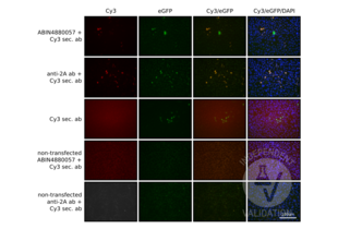 Immunofluorescence validation image for anti-CRISPR-Cas9 (N-Term) antibody (ABIN4880057) (CRISPR-Cas9 (N-Term) anticorps)