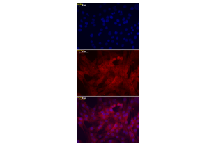 Immunocytochemistry validation image for anti-Superoxide Dismutase 1, Soluble (SOD1) (AA 2-154) antibody (ABIN3058918) (SOD1 anticorps  (AA 2-154))