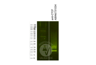 Cleavage Under Targets and Release Using Nuclease validation image for anti-CCCTC-Binding Factor (Zinc Finger Protein) (CTCF) antibody (Sortase,His tag,AVI tag) (ABIN6731034) (Recombinant CTCF anticorps  (Sortase,His tag,AVI tag))