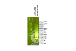 Cleavage Under Targets and Release Using Nuclease validation image for anti-RAD21 Homolog (RAD21) (N-Term) antibody (ABIN6731038)