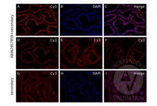 IF staining of prostate from inducible AR-lacZ mouse with ABIN2957859 shows robust staining for the AR at 1:100 dilution (A) and colocalization with nuclear DAPI staining (B, C). Staining becomes weaker and aspecific staining more pronounced at higher dilution factors 1:200, 1:300, and 1:500 (D, E, F). Non-specific signal in the secondary antibody-only control is both extracellular and nuclear. Exposure 5x of that used to image ABIN2957859 was used in G to capture the non-specific signal in the TRITC channel. H shows DAPI imaged at 100ms and I shows that the non-specific signal is both extracellular and nuclear, as shown by the partial colocalization of the non-specific signal with DAPI. 