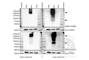 Western blot analysis of cell lysates from CHO-K1 cells transfected with a human GRM6 expression plasmid (pos) or untransfected cells (neg) using ABIN2704985 (top), ABIN1533291 (bottom) with short or long exposure times, or an anti-GAPDH loading control antibody. Arrows indicate what appear to be GRM6 monomers and dimers. 