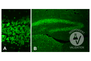 Histone H4 (acLys12) positive nuclei in the mouse brain. A: Immunoreactive nuclei in the granular layer of the cerebral cortex (original magnification 20x). Microwave antigen retrieval. B: Immunoreactive nuclei in the hippocampus. Note the intense staining