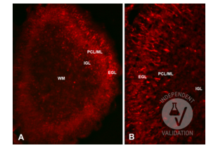 Immunohistochemistry validation image for anti-Reelin (RELN) (N-Term) antibody (ABIN6264693)