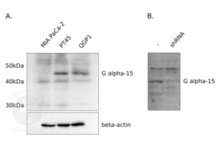 Western Blotting validation image for anti-Ga16 antibody (ABIN110590)