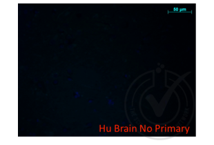 Immunofluorescence validation image for anti-Amyloid beta (A4) Precursor Protein (APP) (AA 666-670) antibody (ABIN197433) (APP anticorps  (AA 666-670))