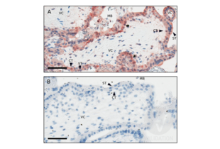 Representative villus from a 7 week gestation normal pregnancy with “normal karyotype” as determined by PCR testing to exclude trisomy, and digitally photographed at 400x. Staining with CD200R1L antibody ABIN1715098 (A) or KLH antibody ABIN401183 (B). VC: villus core, CT: cytotrophoblast, ST: syncytiotrophoblast, MB: maternal blood space bathing placental villi. Note more intense staining of cytotrophoblasts compared to syncytiotrophoblasts. Bars represent 60µm.