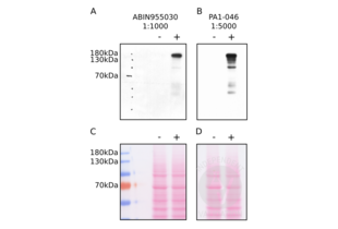 Western Blotting validation image for anti-Synaptic Ras GTPase Activating Protein 1 (SYNGAP1) (AA 1169-1183), (Internal Region) antibody (ABIN955030) (SYNGAP1 anticorps  (Internal Region))