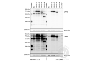 Western Blotting validation image for anti-G Protein-Coupled Receptor Kinase 6 (GRK6) (AA 382-417), (C-Term) antibody (ABIN3042435)