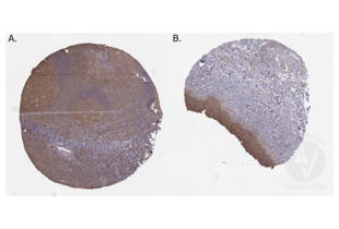 Staining of human tonsil (A.) and urinary bladder (B.) sections in a tissue microarray with ABIN3044198. See the protocol for detailed information.
