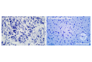 Positive control with Alkaline Phosphatase Anti-Digoxigenin antibody on P5 CD1 mouse brain. Images show reaction with and without DNase treatment to increase cellular death. Magnification: 40x.