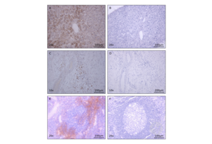 Immunohistochemistry validation image for anti-Interleukin 8 (IL8) antibody (ABIN1724413) (IL-8 anticorps)