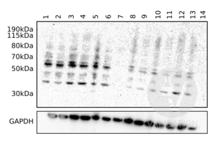 Immunoblot using ABIN657704 on human endothelial cell and human astrocytes lysates. C9 protein band intensity is increased in the human endothelial cell after 24h (lane 1-6) compared to 48h (lane 8-13) when treated with nanoparticles. Negative controls are endothelial cells (lane 7) and astrocytes (lane 14) without nanoparticle treatment. 