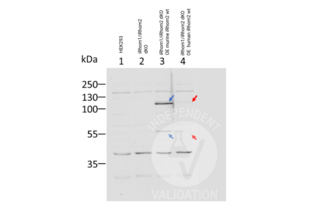 Western blot using ABIN2846535 to reveal iRhom2 (full length 110 kDa, cleaved 55 kDa) in lysates from HEK293 cells (1), HEK293 iRhom1/iRhom2 double knockout (dKO) (2), HEK293 iRhom1/iRhom2 dKO + overexpression of human iRhom2 wt (3), HEK293 iRhom1/iRhom2 dKO + overexpression of murine iRhom2 wt (4)