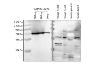 Western Blotting validation image for Bridging Integrator 1 (BIN1) (Transcript Variant 8) protein (Myc-DYKDDDDK Tag) (ABIN2715270)