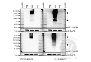 Western blot analysis of cell lysates from CHO-K1 cells transfected with a human GRM6 expression plasmid (pos) or untransfected cells (neg) using ABIN1533291 (top), ABIN2704985 (bottom) with short or long exposure times, or an anti-GAPDH loading control antibody. Arrows indicate what appear to be GRM6 monomers and dimers. 
