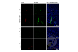 Low and high magnification pictures of CHO-K1 cells, transfected with a plasmid expressing human GRM6 and turbo Red Fluorescent protein (tRFP) stained with ABIN1533291 and an AF488 conjugated secondary antibody (AF488). Co-labeling of tRFP and GRM6 indicates the specificity of the antibody. Non-transfected cells (non-transfected) and transfected cells stained with the secondary antibody only (secondary) served as negative controls. 