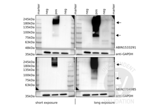 Western Blotting validation image for anti-Glutamate Receptor, Metabotropic 6 (GRM6) (AA 828-877) antibody (ABIN1533291)