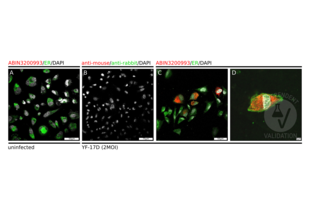 1205Lu melanoma cells infected (B, C, D) and uninfected (A) with yellow fever vaccine strain YF-17D were stained with anti-Flavivirus E protein antibody ABIN3200993 and an ER-specific antibody (A, C, D) and AF647- (red) and AF488-conjugated (green) secondary antibodies or only with the secondary antibodies (B). DAPI counterstain (white) was used to reveal cells.
