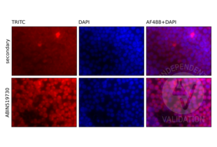 U937 monocytic cells stained with with anti-RelB antibody ABIN519730 and a TRITC-labeled secondary antibody (bottom row, red). Counterstain with DAPI (blue). Negative control without primary antibody (top row) shows no specific TRITC signal. 