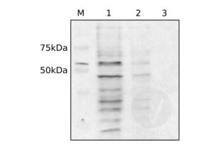 DYNC1Li1 protein detection with ABIN2790248 after western blotting on nitrocellulose membrane. Cell lysates made from about 500.000 (1), 125.000 (2) or 25.000 (3) A549 cells were separated on a 10% acrylamide SDS-PAGE gel and blotted on a nitrocellulose membrane. DYNC1Li1 detection was performed using ABIN2790248 as primary antibody, followed by a secondary donkey-anti-rabbit-HRP antibody and ECL Western blotting substrate. M: marker