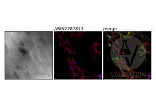 Immunohistochemistry validation image for anti-Nardilysin (N-Arginine Dibasic Convertase) (NRD1) (Middle Region) antibody (ABIN2787813) (NRD1 anticorps  (Middle Region))