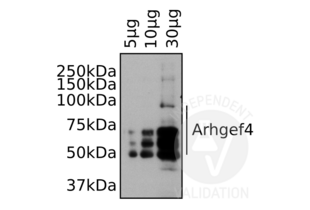 Western Blotting validation image for anti-rho Guanine Nucleotide Exchange Factor (GEF) 4 (ARHGEF4) (N-Term) antibody (ABIN2787993) (ARHGEF4 anticorps  (N-Term))
