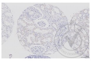 Figure 3: Human kidney stained only with secondary antibody (primary antibody omitted) (brown).