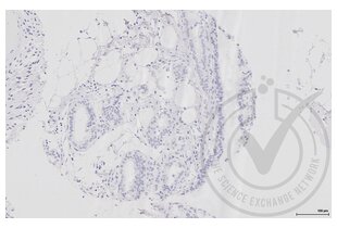 Figure 5. Human breast stained with isotype control antibody (brown). 