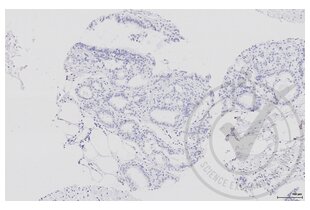 Figure 6: Human breast stained only with secondary antibody (primary antibody omitted) (brown).