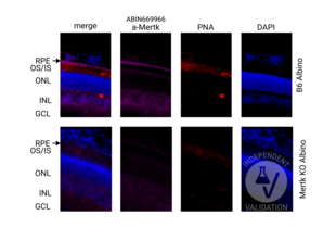 Retinal sections from the wild-type (B6 albino) and Mertk knock-out (albino) mice immunostained with anti-MERTK antibody ABIN669966. DAPI staining shows localization of the inner (INL) and outer (ONL) nuclear layer of the mouse retina. PNA co-staining was used to visualize cone inner and outer segments (IS/OS) in the retina. Presence of specific signal in the RPE cell layer confirms specific immunoreactivity.