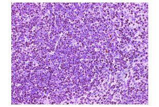 Figure 1: Mouse spleen stained with anti-CD4 (brown) and counterstained with hematoxylin.