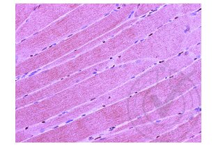 Figure 2: Mouse muscle stained with anti-CD4 (brown) and counterstained with hematoxylin.