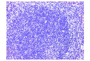 Figure 3: Mouse spleen stained with isotype control antibody (brown) and counterstained with hematoxylin.