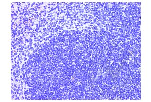 Figure 4: Mouse spleen stained with secondary antibody only (brown) and counterstained with hematoxylin.