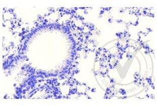 Immunohistochemistry validation image for anti-Coagulation Factor III (thromboplastin, Tissue Factor) (F3) (AA 32-100) antibody (ABIN708086)