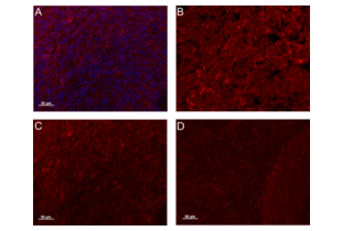Immunohistochemistry (Formalin-fixed Paraffin-embedded Sections) validation image for anti-Cysteine-Rich, Angiogenic Inducer, 61 (CYR61) (AA 251-379) antibody (ABIN674499)