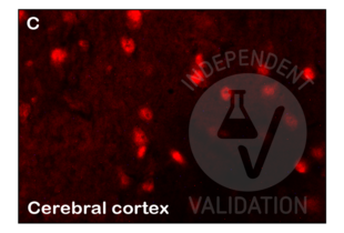 Immunohistochemistry validation image for anti-Insulin-Degrading Enzyme (IDE) (AA 491-590) antibody (ABIN723665)