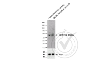Figure 1. Western blot of lysates from HeLa cells (Lane 1) and c6/36 cells (Lane 2) probed with anti-MAP2K2 (upper panel) or with anti-Actin for loading control (lower panel). 