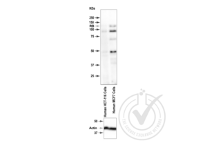 Figure 1: Western Blot for RB1 (pSer795). Grey arrowhead indicates the expected molecular weight of ~100-105 kDa.