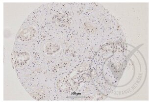 Figure 1: TJP1 immunostaining of human testis (brown). Counterstain in blue. 