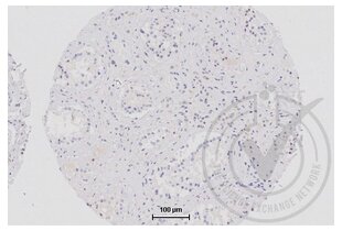 Figure 2: Isotype control immunostaining of human testis (brown). Counterstain in blue. 