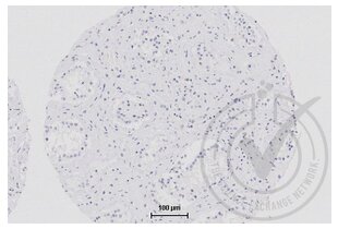 Figure 3: Secondary only control immunostaining of human testis (brown). Counterstain in blue. 