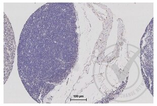 Figure 4: TJP1 immunostaining of human thymus (brown). Counterstain in blue. 