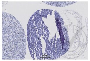 Figure 6: Secondary only immunostaining of human thymus (brown). Counterstain in blue. 