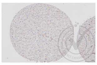 Figure 2: Human liver tissue stained with anti-RAF1 (brown) and counterstained with hematoxylin. 