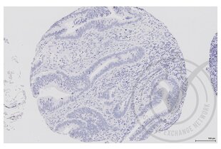 Figure 4: Human colon tissue stained with secondary atnibody only (brown) and counterstained with hematoxylin. 