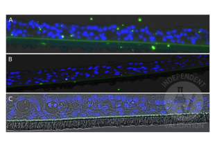 Immunohistochemistry validation image for anti-Rhinovirus antibody (ABIN5688681)
