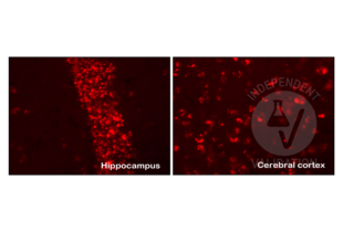 Staining of beta-amyloid positive neurons in the hippocampus and cerebral cortex of a 3-month-old transgenic mouse using ABIN5508784. Tyramide amplification. No counterstain. 